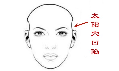 太阳穴凹陷的人好不好,太阳穴凹陷揭秘婚姻运势
